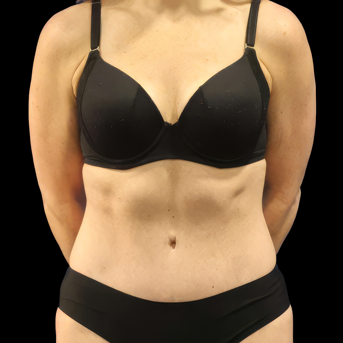 Patient portrait after treatment