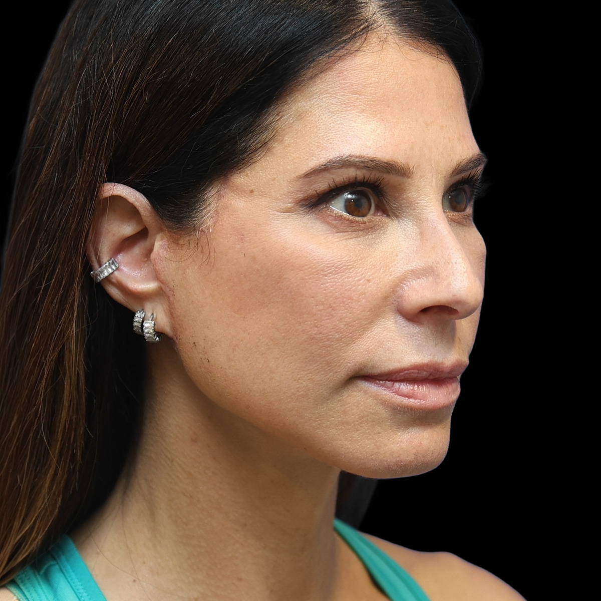 Patient portrait after treatment